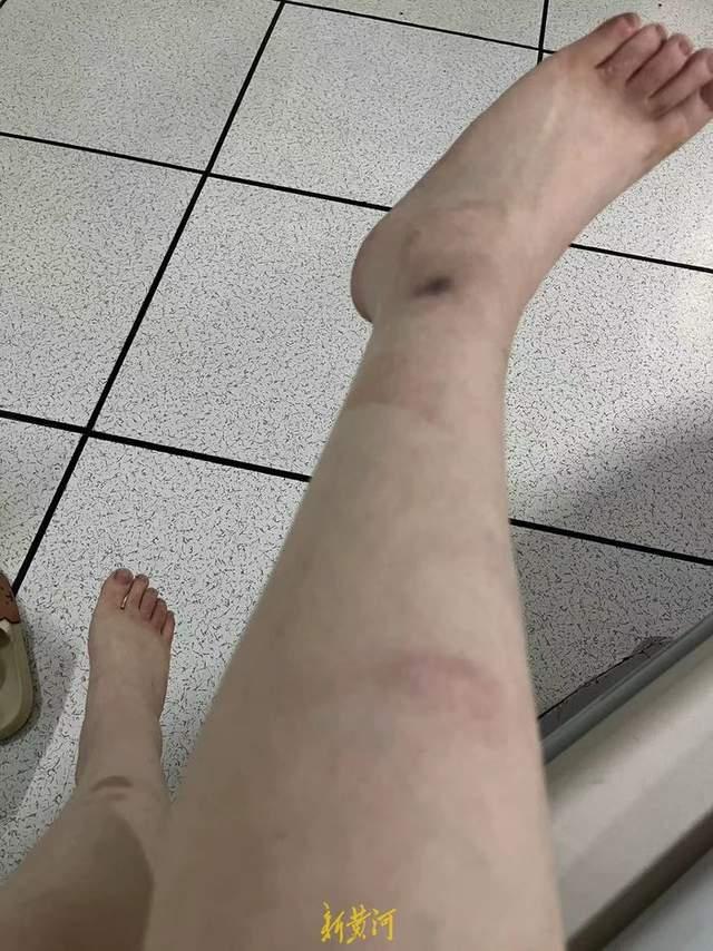 女子称被辅警猥亵后强制送入精神病院两个月 警方回应:正调查,涉事辅警已辞职(图4) 女子称被辅警猥亵后强制送入精神病院两个月 警方回应:正调查,涉事辅警已辞职(图4)